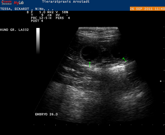 UStrchtigkeit31Tage1_80